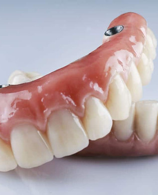 protesis-dental-clinica-dental-julian-saiz-01.jpg