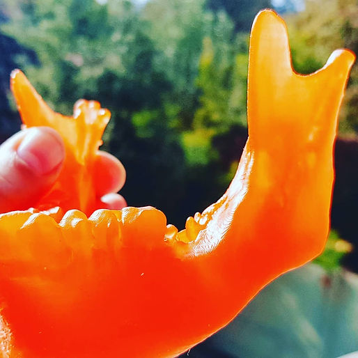 Impresion 3d de una mandíbula