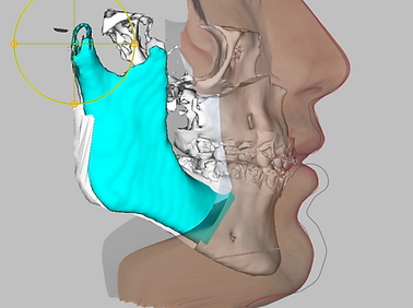 perfil maxilofacial.png